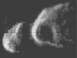[Image radar de Toutatis en 1994]